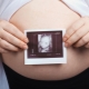 Ultrasound at 32 weeks gestation: fetal size and other features