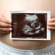 Ultrasound in the 33rd week of pregnancy: fetal size and other features