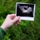 Ultrasonido a las 4 semanas de gestación.