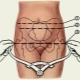 Narrow pelvis during pregnancy and its clinical form