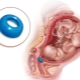 Why establish an obstetric pessary during pregnancy and when it is removed?