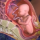 What does the placenta look like and where is it attached?