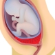 The position of the placenta in relation to the internal throat