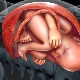 Tipos de unión del cordón umbilical a la placenta: normas y riesgo de desviaciones