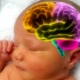 Organic brain damage (encephalopathy) in children