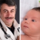 Doctor Komarovsky on how to remove the crusts on the baby’s head