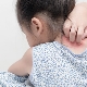 Psychosomatische oorzaken van psoriasis bij kinderen en volwassenen