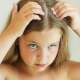 Dandruff psychosomatics in children and adults