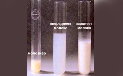 Mom's front and back milk, colostrum - color and consistency