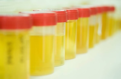 Contenitore per la raccolta delle urine