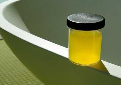 Turbid urine