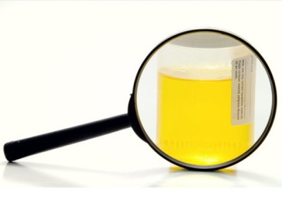 Urine analyse