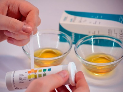 Test strips for determination of acetone in the urine