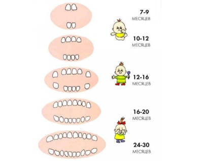 Denti in un bambino in 2 anni