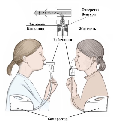 Compresia funcționării nebulizatorului - schemă